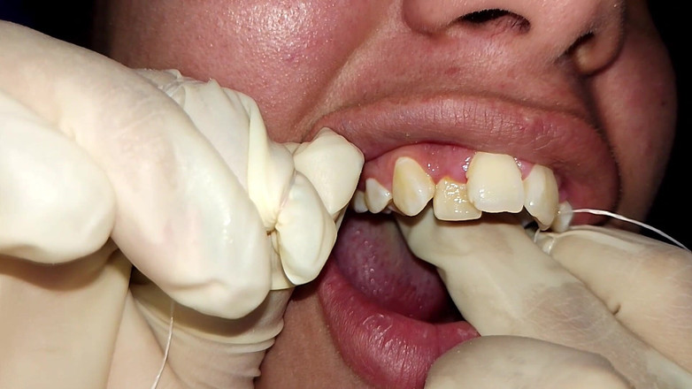 Elimoon: Pokus o používání zubní nitě (detailní záběr)