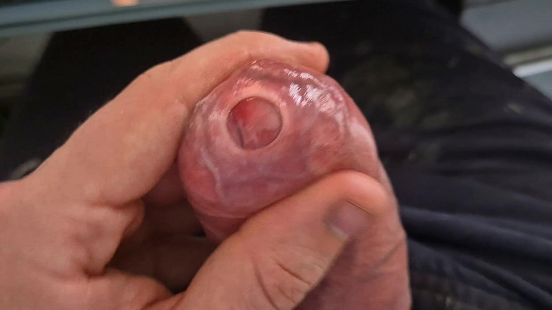 GloomyChase977: Un grande papà non circonciso .. Gioco di prepuzio stretto di...