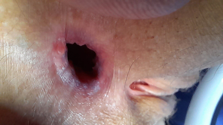 Lala Licious: Büyük Agape, nihai sonuç