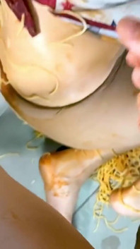 Incydent analny ze spaghetti
