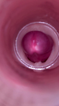 Ženské inseminace - vnitřní kamera zachycuje hlubokou mužskou ejakulaci