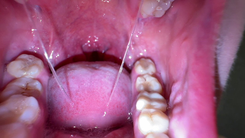 Hottie goddess: Pengekstrakan deepthroat langsing: pengeringan muktamad &amp; permainan mukus