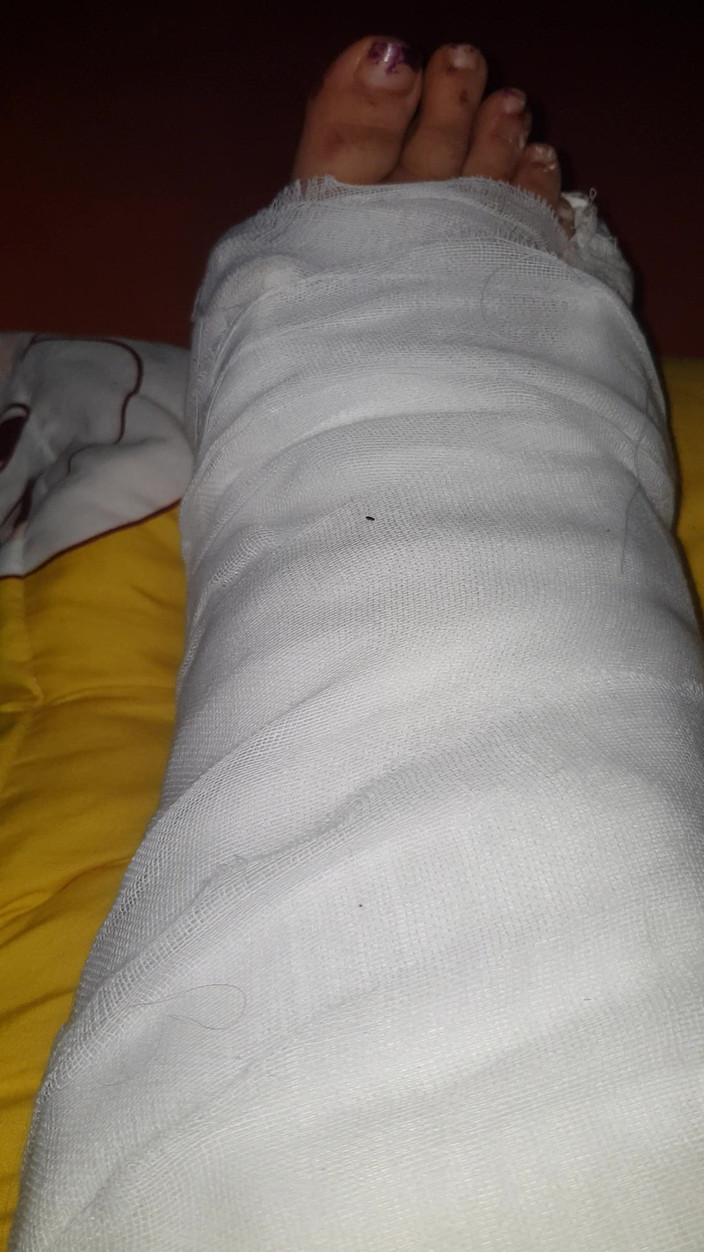 LoraBbw: Kroutí prsty na nohou v castingu