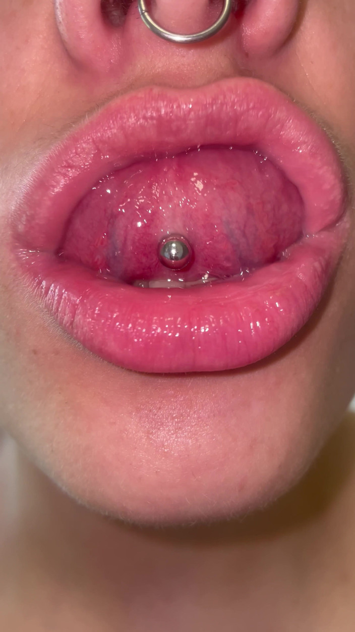 Glitterqueen1999: Mouth Tour No Makeup Teeth Tongue Uvula Tonsils Check