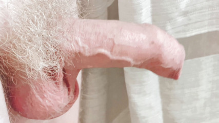 Archie Donald: मुलायम पीला लंड मोटा हो जाता है। दो दृश्य। वहां बड़ी गेंदें