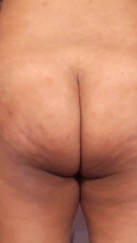 Ass Movements