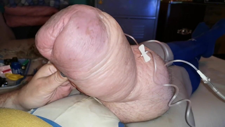 Monster_Meat_: Powrót Cockzilla po dodaniu glukozy 2liters