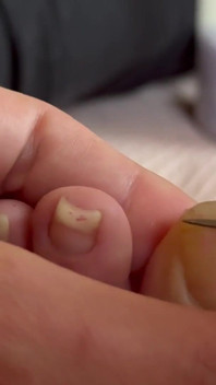 All Natural Long Toe Nail Fetish Video Closeup Toes Foot Feet