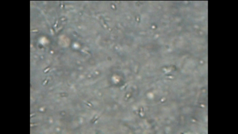 Mark Hannes: Sexdoll中出站着自慰，在显微下用精子自慰