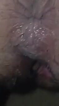 Anal Sex