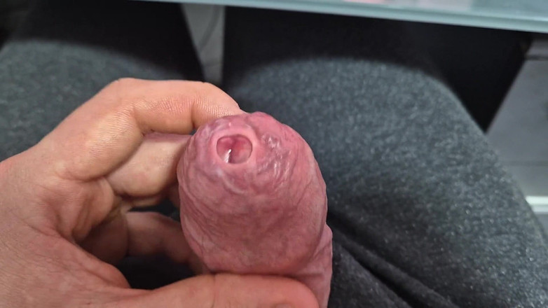 GloomyChase977: 사정으로 쪼이는 Phimosis 포피 스트레칭!