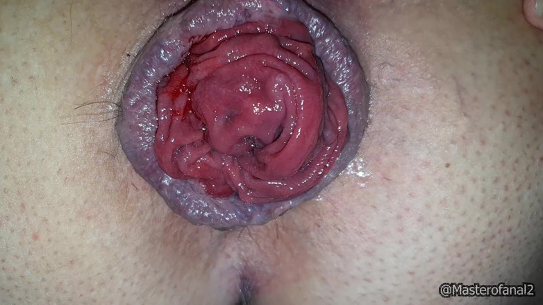 Violet Buttercup: Giantess Anal and Pussy - Speculum and Farting