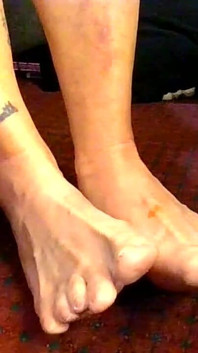 Natural Toe Wiggling