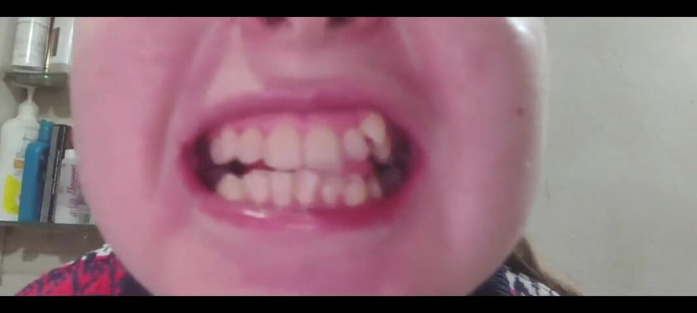 RavenHearth666VIP: Ich zähneputzen