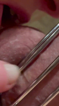 Chastity Belt First Time on His Dick and