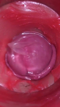 Camera Inside Pussy - Powerfull Cum in Pussy! Best Internal Asmr