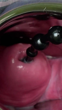 Crazywifeslut Cervix i Peehole Play