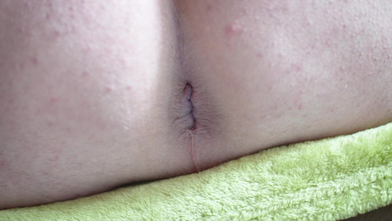 Marcus Pollack Gay: 멍청이 클로즈업