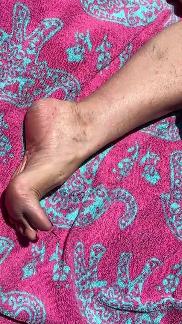 Aunt Ann: Fan Request Granny Naked in Sun Shows Dirty Rough Soles &amp;...