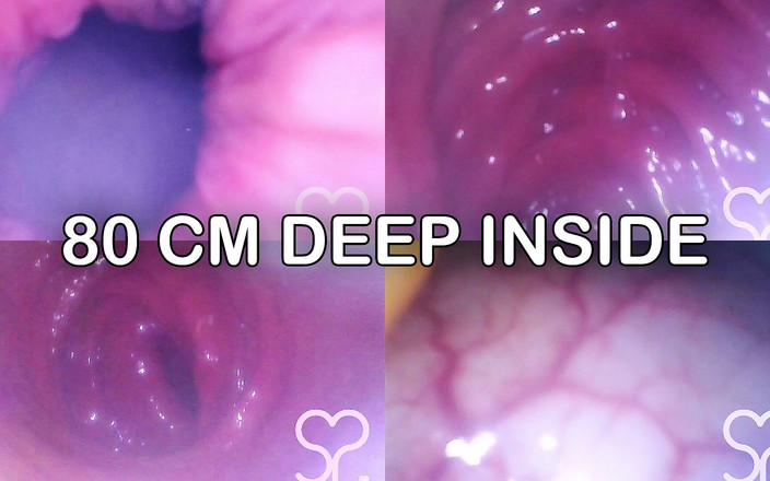 Lina Free: 肛门内窥镜一直插入我的横肠！