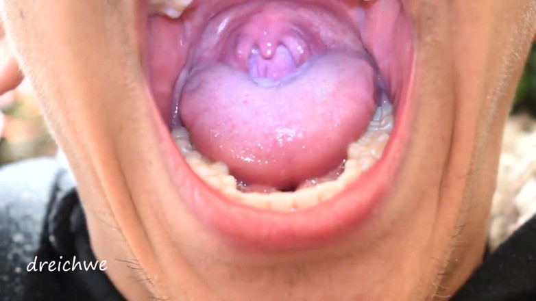 Dreichwe: Uvula fetish mouth