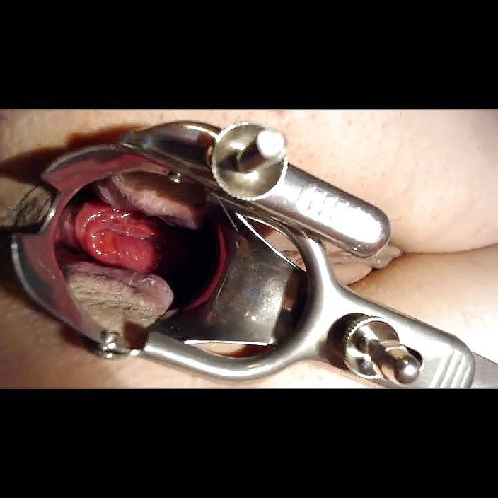 Putarankahotmilf: Espéculo anal, prolapso, poner agua en mi culo y coño,...