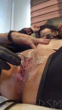 Cipka z bliska: metalowy pręt jest wkładany do cewki moczowej ... Kapiący mocz i sok z cipki ...