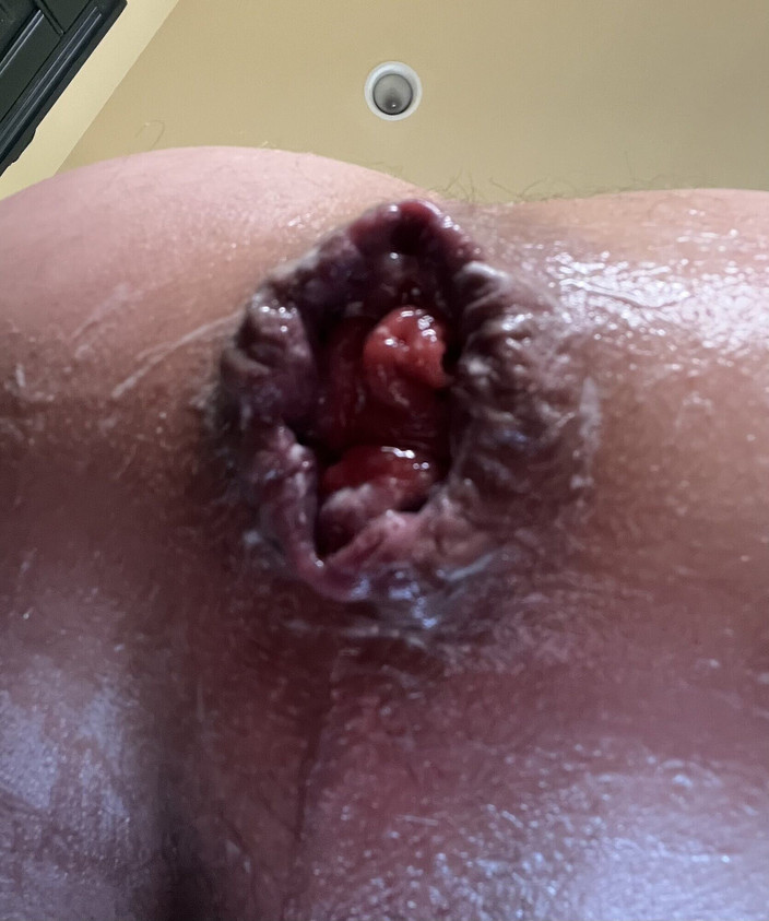 Stacey Loves Anal xxx: फैलाया गया गुदा गांड वीर्य