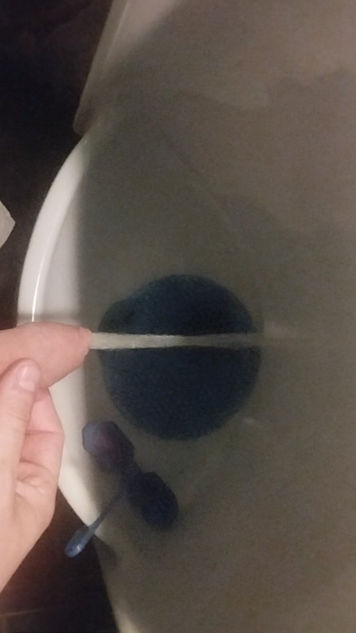 Bayer911: Bayer parte 152