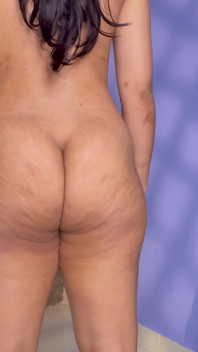 Clench Buttocks