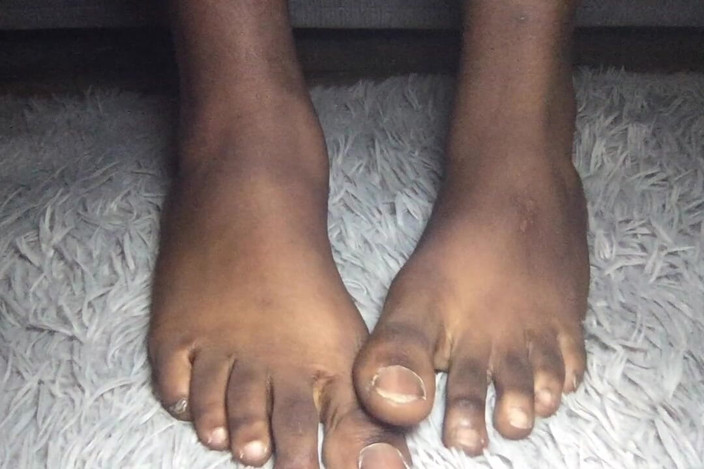 Teddy south: Big Black Feet