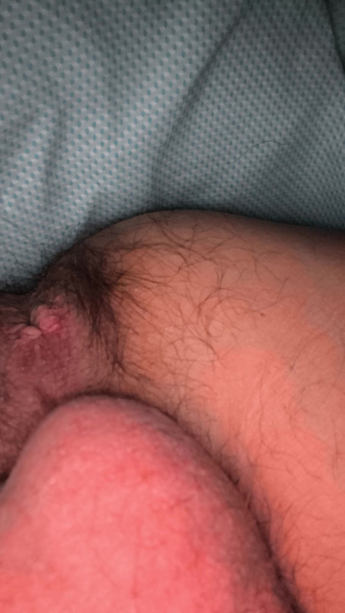 Alison 34monitor: Is Masturbation 2 Fingers Few?