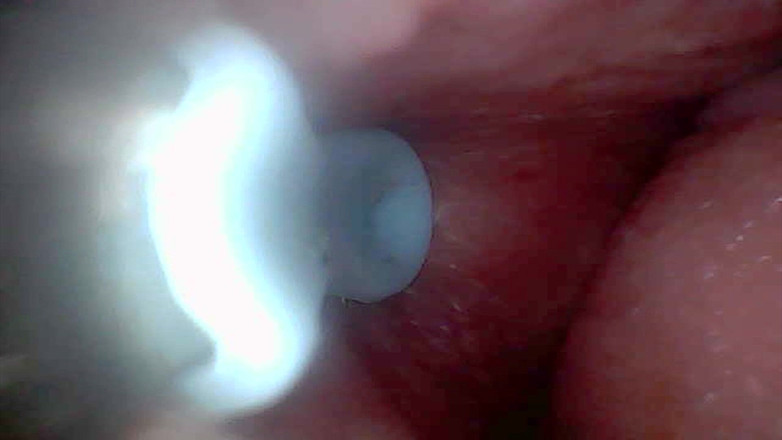 Twittiy: Diamo una sbirciatina nella mia figa succosa insieme (endoscope camera)