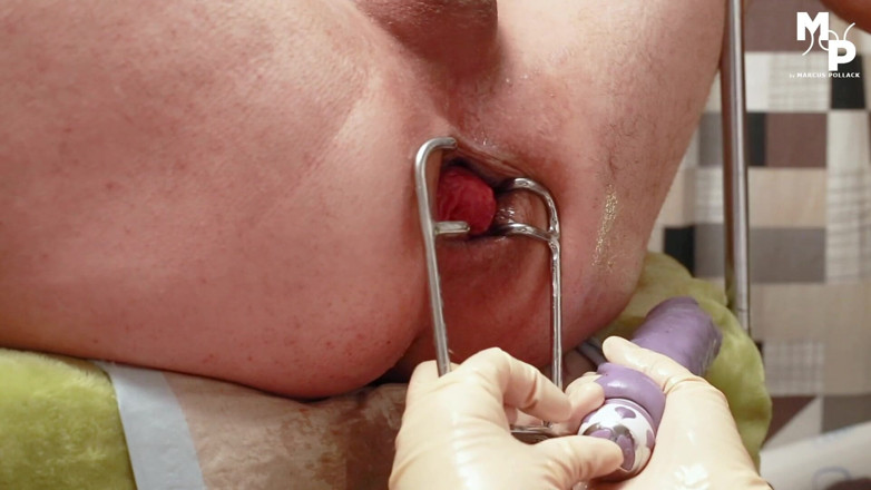 Marcus Pollack: Speculum stretching for subs hole