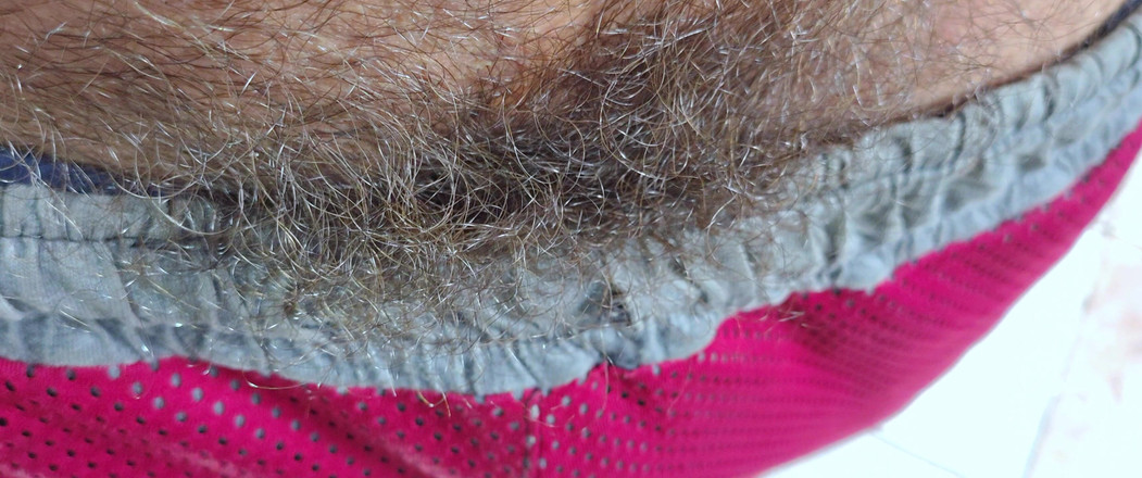 Stink HairyMale: 更接近你