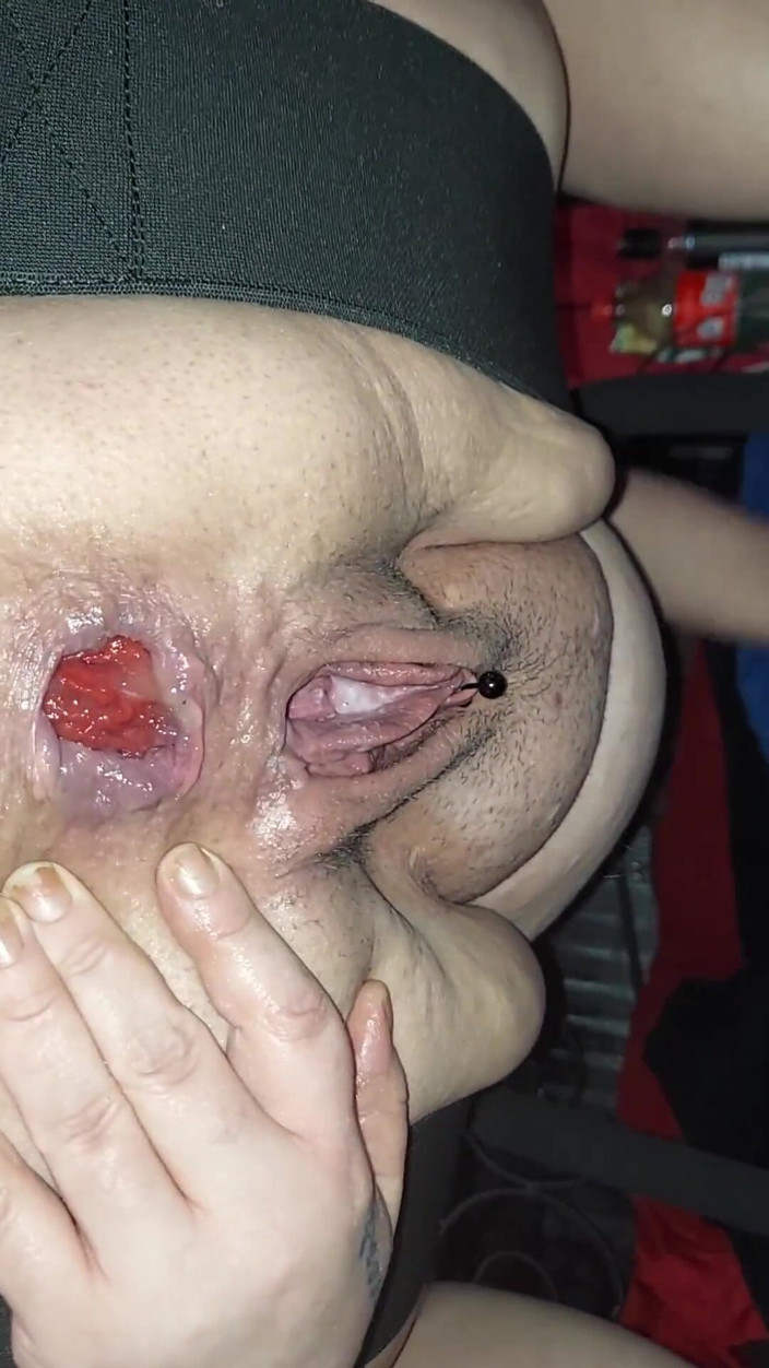 Anal_Angi_Rose: Bbc đồ chơi hậu môn sa