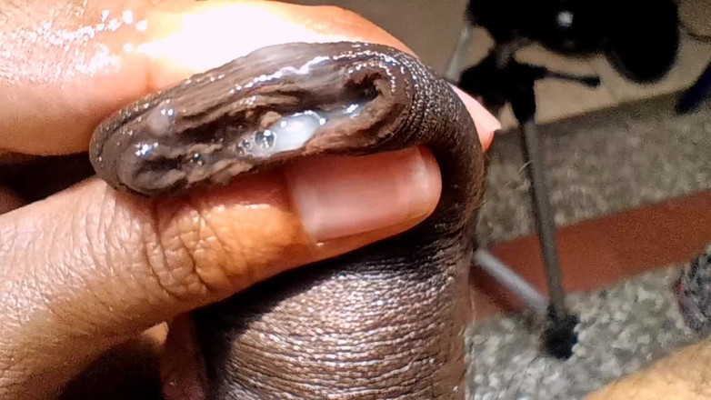 Tommhot: Pancut ke dalam Foreskin