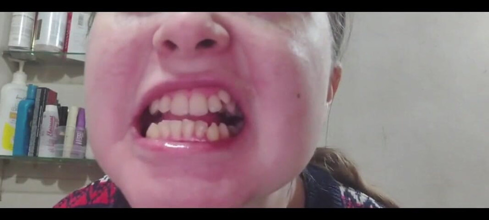 RavenHearth666VIP: Berus gigi saya