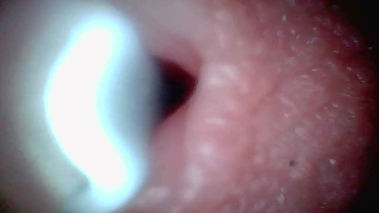 Ladybottox: Endoscope Camera Captures Moment of Male Ejaculation 4K