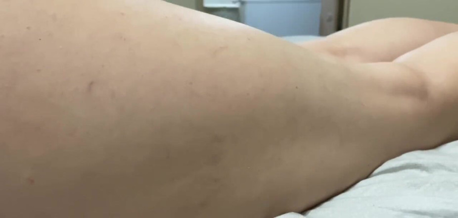 Supernasty: My leg like bed boys