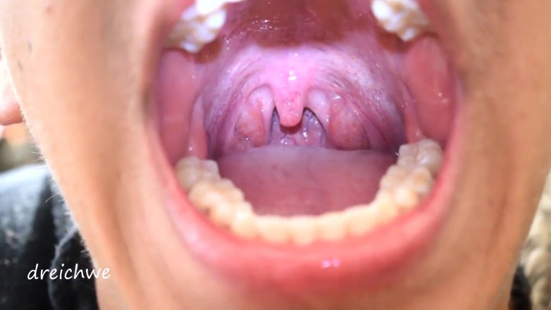Dreichwe: Uvula fetish mouth
