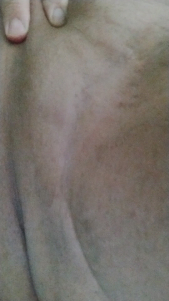 JG Risk: 3-8-2026 Шоу Taint