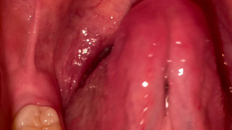Glitterqueen1999: Mouth Tour No Makeup Teeth Count Uvula Check Tonsil Check