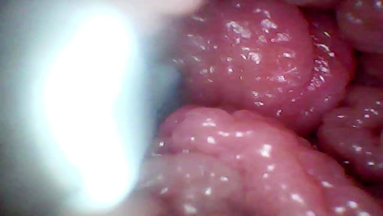 Ladybottox: Endoscope Camera Records My Wife's G Spot. Educational Video Close...