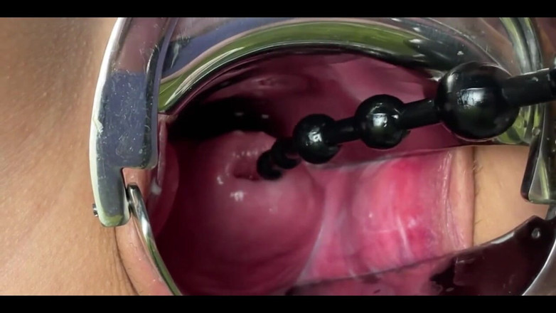 Crazywifeslut: Close up Gyno Masturbation
