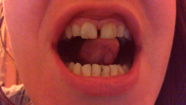 Nicoletta Embassi: Teeth Fetish Devour