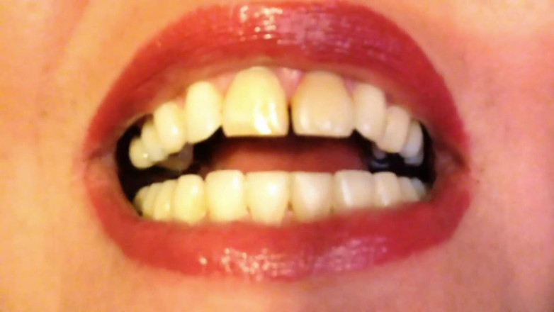 Lily Lipstixxx: Mouth inspection - Be careful, I bite!