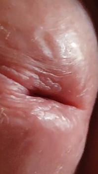 Grandpa Big Red Hole in Amateur Close up.