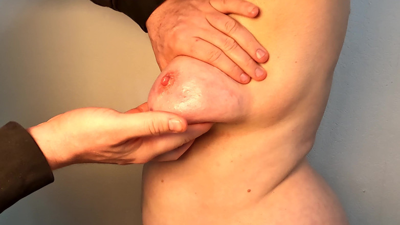 Bouncy Tits Action: 500 Blows on the Left Tit Until Swollen
