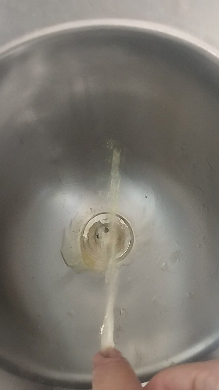 Bayer911: Doccia dorata estiva all'aperto